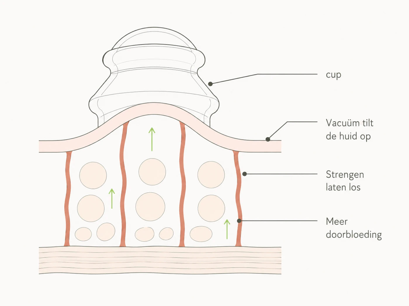 Hoe de cup werkt, het vacuüm tilt de huid op en masseert het bindweefsel